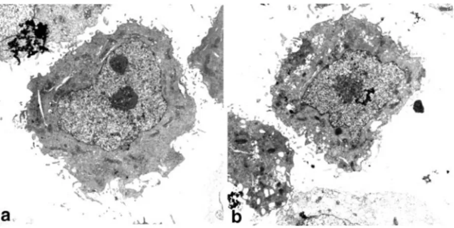 Fig. 2 Images of nuclear components segmented by grey-level threshold from electron micrographs of a calcimycin-treated nucleus (24 h)