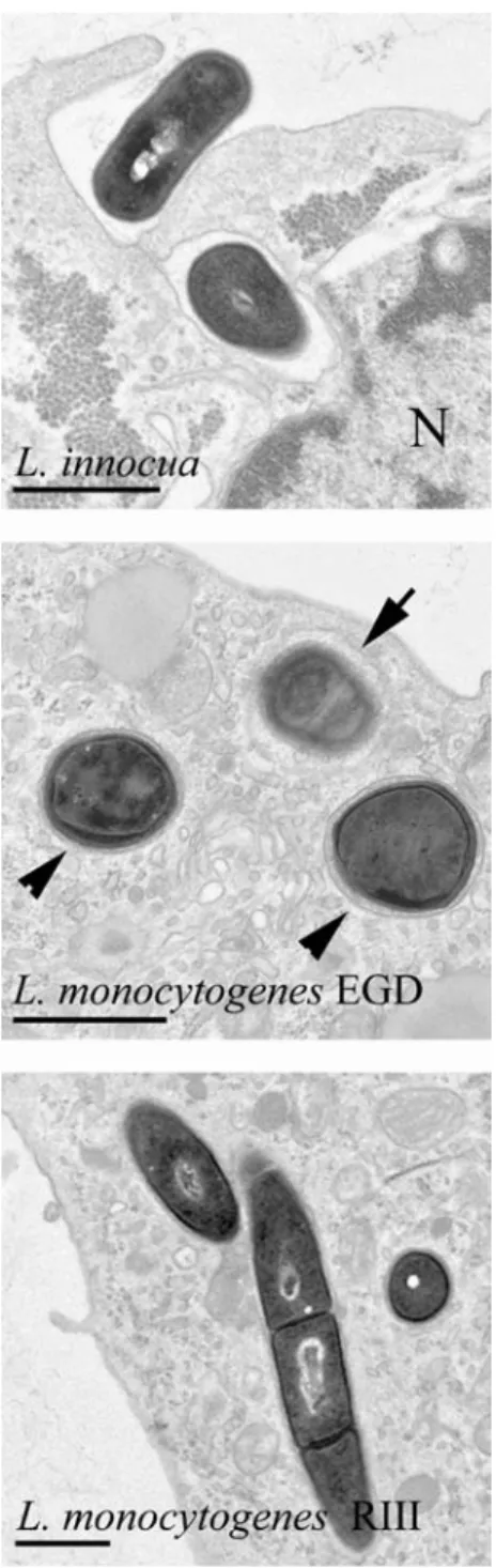 Fig. 1 Entry and intracellular localization of Listeria innocua and L. monocytogenes strains in dendritic cells (DC) visualized with transmission electron microscopy (TEM)