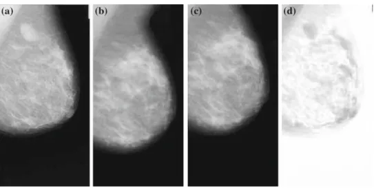 Fig. 2 a The reference image, b asymmetric floating image, c the registered image using the proposed TPS interpolation, d difference between the reference and registered image