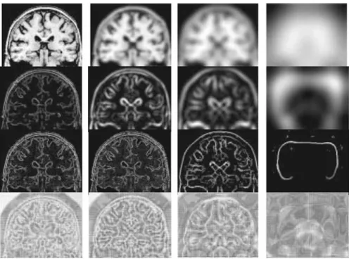 Figure 8. First row presents the linear scale space of a 2-D brain image at four different scales of observation