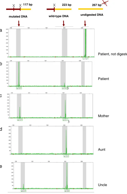 Fig. 1 Results of capillary elec- elec-trophoresis obtained after PCR amplification (a) and DdeI  di-gestion of DNA extracted from blood (b – e)