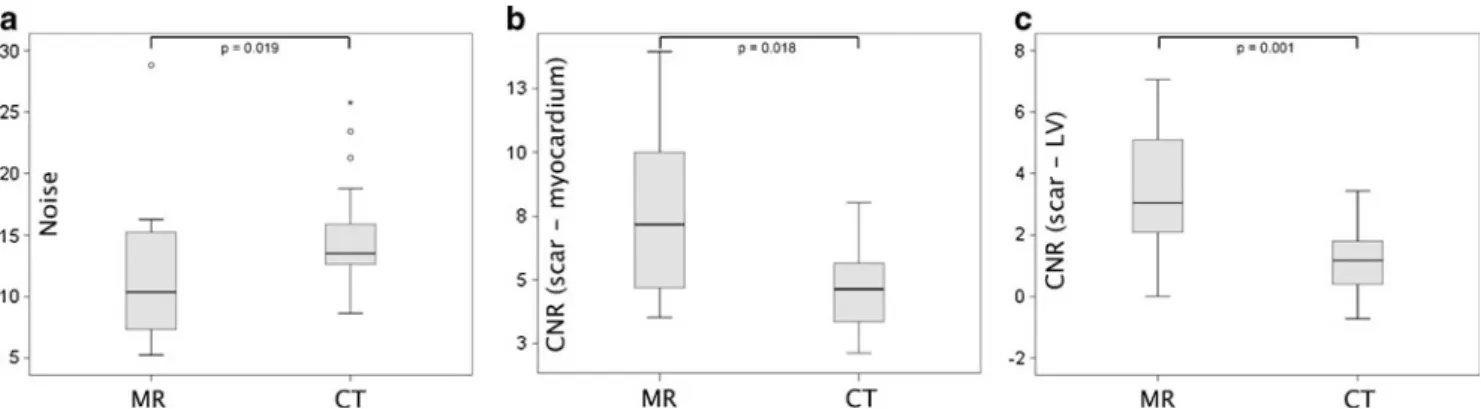 Fig. 2 Delayed enhancement imaging with MRI (upper row) and CT (lower row) in a 74-year-old patient with known occlusion of the distal right coronary artery showing transmural delayed enhancement in basal and midventricular segments (arrowheads)