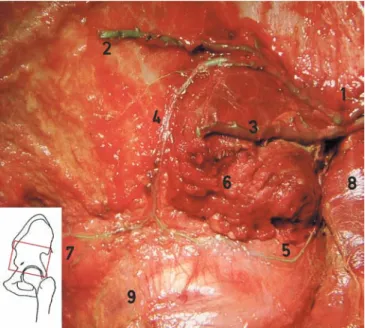 Fig. 1 Lateral view of a left hip after removal of the gluteus medius and parts of the gluteus minimus