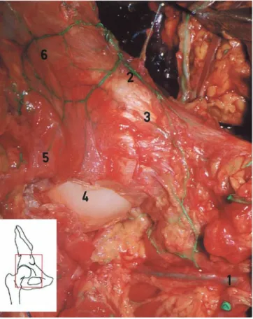 Fig. 3 Anterior view of a right hip. Two branches of the medial femoral circumﬂex artery (MFCA) (1) are given to the anterior wall