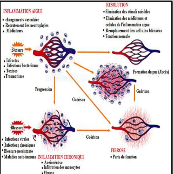Figure 1 : Evolution de l’inflammation aiguë (Kumar et al., 2007). 