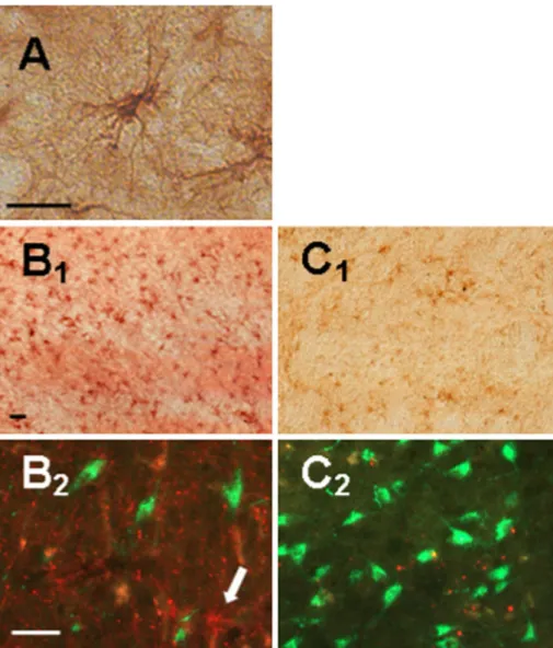 Fig. 1 Photomicrographs depicting the relationship between gliosis (GFAP staining of astrocytes) and hypocretin neurons