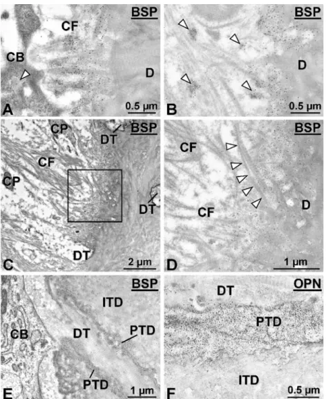 Fig. 5 Transmission electron micrographs showing various initial developmental stages of the interfacial region between repair  ce-mentum and resorbed dentin ( D )