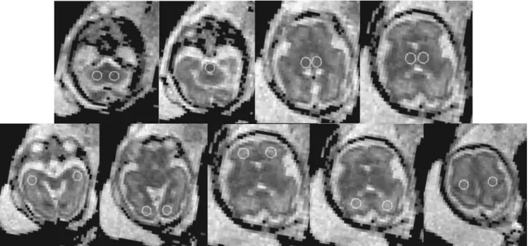 Fig. 1 Localization of the ROIs within all analyzed brain areas of a fetus at 28th GA