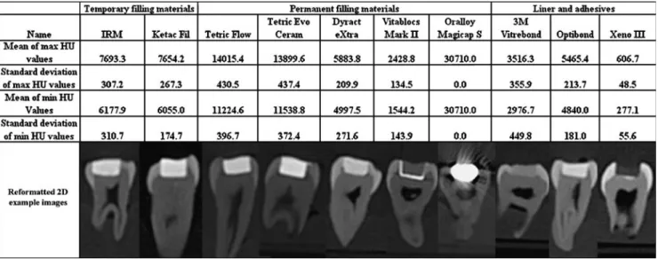 Fig. 3 Preset tested on a data set including five different study teeth in lateral and cranio-caudal view (temporary filling 4+5 mm [IRM] — green, high radiopaque definite filling 4+5 mm [Tetric Flow Cavifil] — red, low radiopaque definite filling 4+5 mm [