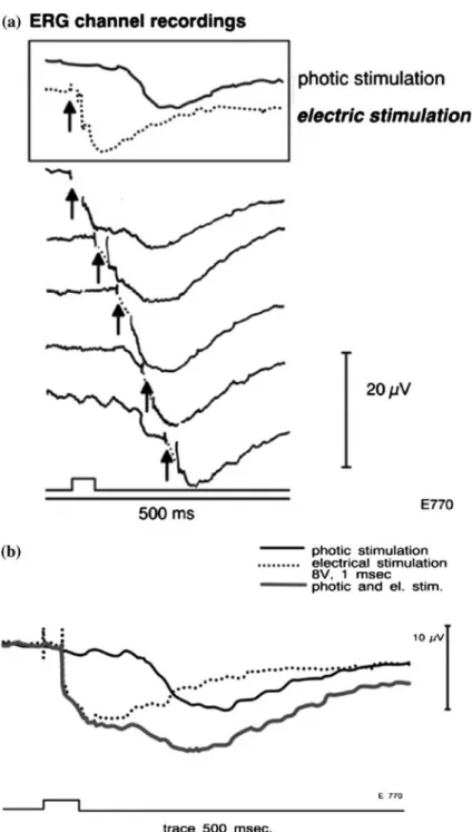 Figure 7. Traces from the ERG channel in perfused cat eyes revealing the light evoked STR as well as retinal negative potentials elicited by antidromic electrical stimulation of the optic nerve