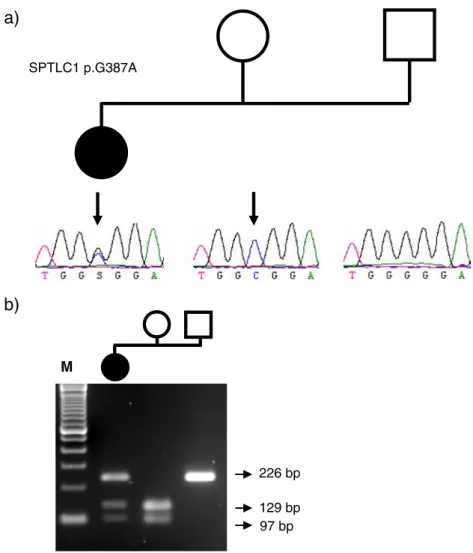 Fig. 4 The G378A missense mutation in SPTLC1 is not necessarily associated with HSAN I