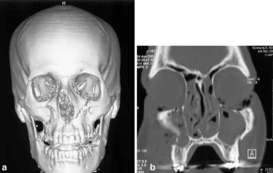 Fig. 2 Three-dimensional sur- sur-face shaded display image.