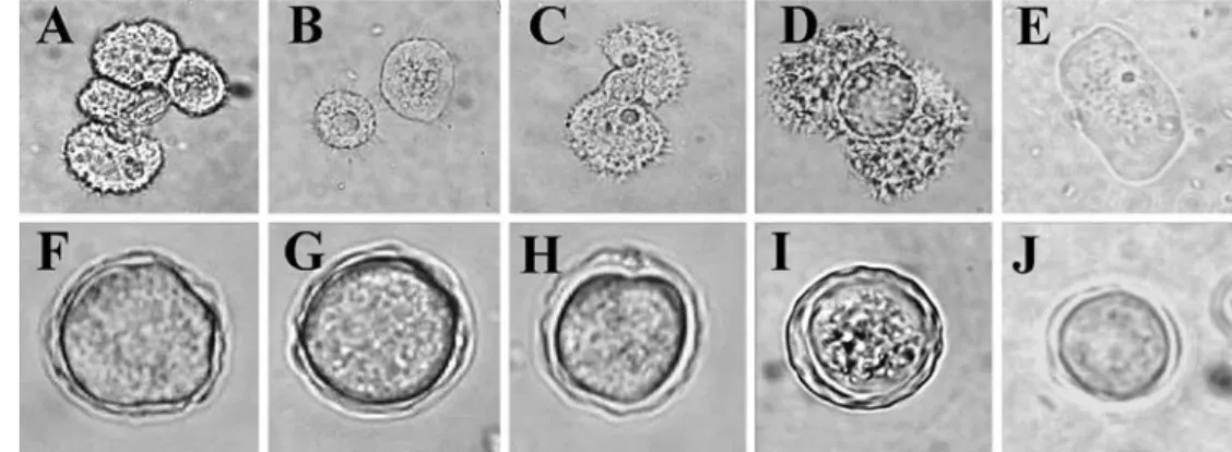 Fig. 1 Photomicrographs of representative trophozoites (A–E) and cysts (F–J) of indigenous amoebae clones used in the study: