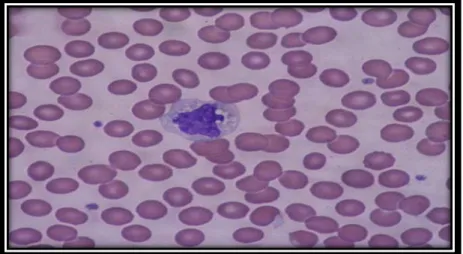 Figure 7 : un monocyte observe sous microscope (16)  I.3.1.2.  Les macrophages 