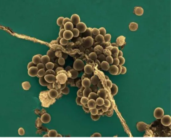 Figure 5 : Observation microscopique de Staphylococcus aureus(Bioquel) 