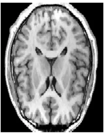 Figure 1.2 : Image par IRM. 