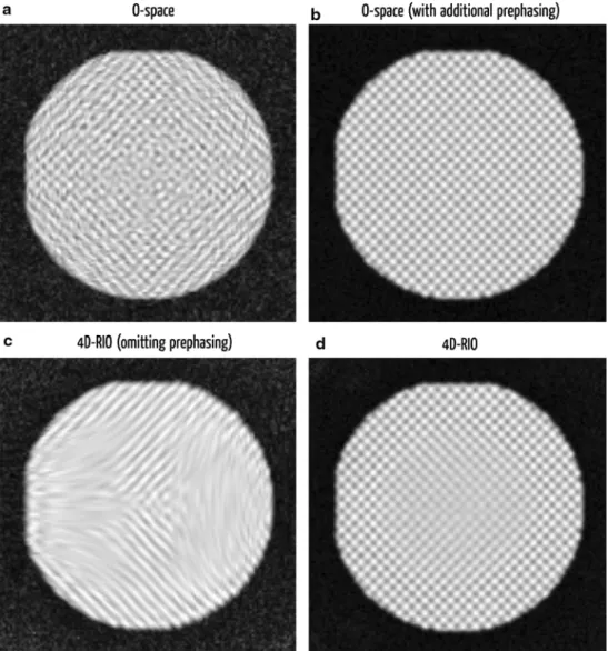 Figure 5 shows the reconstructed images using the CRCPO and 4D-RIO trajectories, with and without prephasing