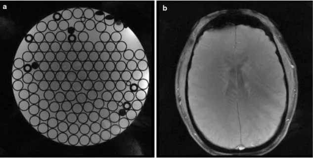 Figure 8 shows the reconstructed images obtained with various degrees of sparsification of E F1 / or E F2/ 