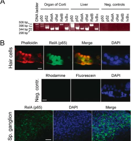 FIG. 1. NF-kB/Rel expression in the cochlea. (A) RT-PCR showing expression of NF-kB/Rel mRNA in p5 rat organs of Corti and liver (positive control)