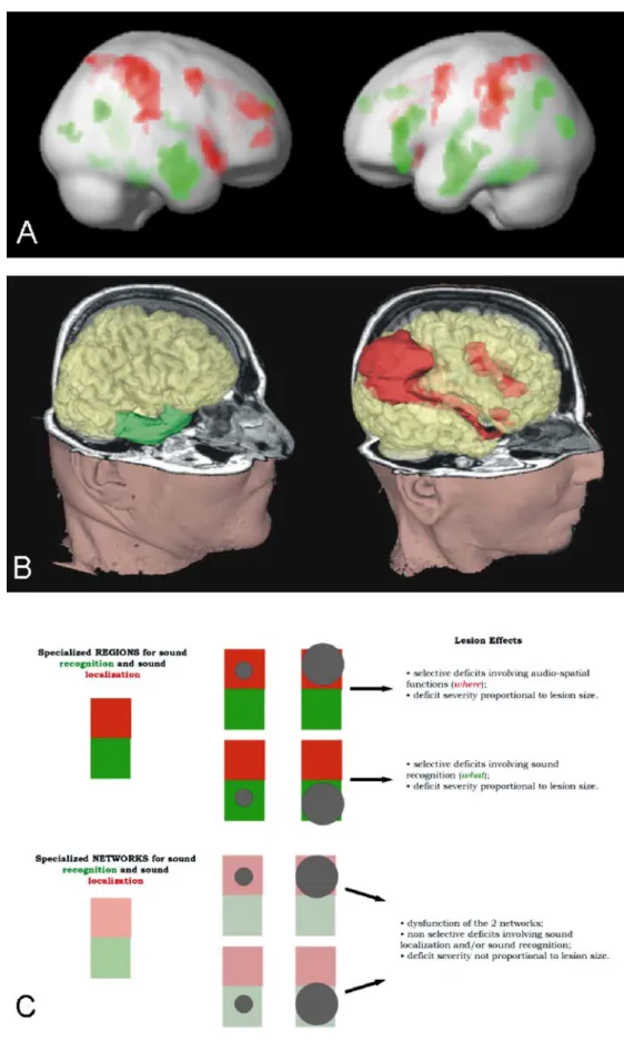 Fig. 1a – c Cortical networks involved in sound recognition and sound localization. a Mean activation of 18 normal subjects in a functional MRI (fMRI) study on sound recognition and sound localization; green  de-notes regions activated more by sound recogn