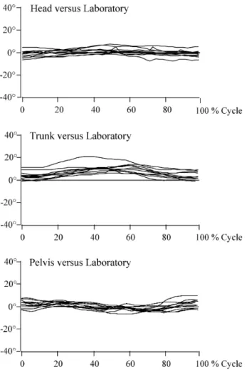 Table 3 Static and dynamic rotation of the trunk in relation to the pelvis. Subjects arranged according to increasing  tho-racic curve