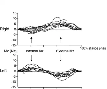 Fig. 5 Free rotational moment Msz [Nm]: median curve of each subject