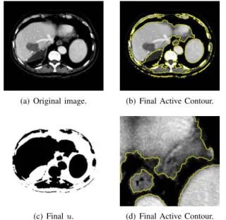 Fig. 8 Segmentation using the Active Contours Without Edges (ACWE) model of Chan–Vese, b, and our model which unifies the ACWE and the geodesic/geometric active contours (GAC), c