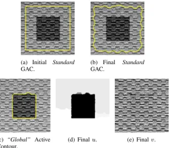 Fig. 4 Global minimization of the active contour/snake model with a dual formulation of the TV-norm proposed in Propositions 1 and 2.