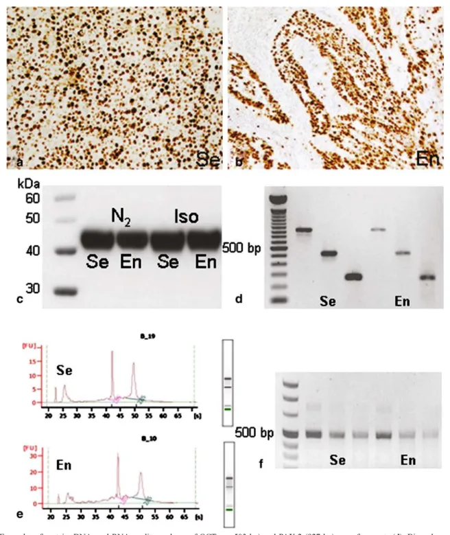 Fig. 3 Examples of protein, DNA, and RNA quality analyses of OCT embedded tumors frozen in isopentane