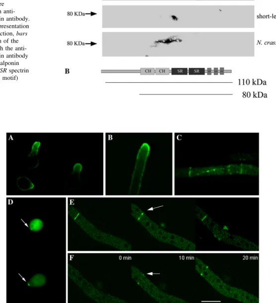 Fig. 2 Localization of a-actinin in N. crassa. a–c Immunolocalization of N. crassa a-actinin during different stages of growth