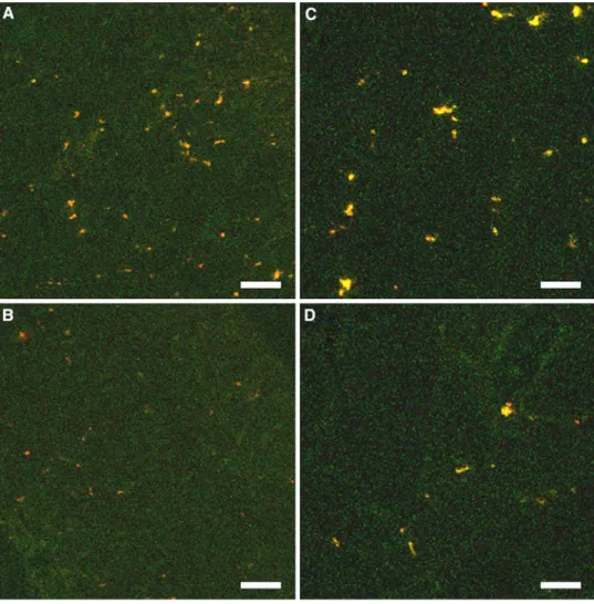 Fig. 3 Upper  W gure: confocal  Xuorescence images of sections  of mdx diaphragm (a) and soleus  (c) muscles containing  numer-ous yellow or orange  autoXuo-rescent lipofuscin (LF) granules  after treatment with saline  com-pared to their sparsity in the  