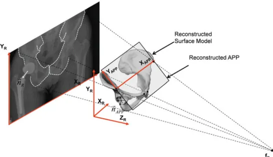 Fig. 2 Schematic representation of how to use the 2D/3D reconstruc- reconstruc-tion-based method to estimate the post-operative cup orientation