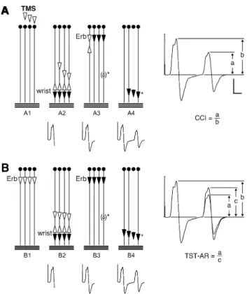 Fig. 1 Triple stimulation technique (TST) principle. The motor tract is simpliWed to four spinal motor neurons (MNs); horizontal lines  repre-sent the abductor digiti minimi (ADM) muscle Wbres supplied by the four neurons