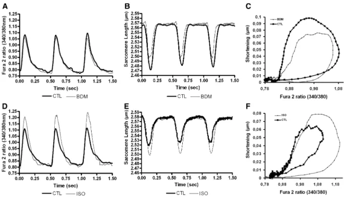 Fig. 3 Characterization of EC-coupling in redifferentiated ARVM exposed to the uncoupling agent 2,3-butanedione  2-monoxime (BDM) or to beta adrenergic stimulation by isoproterenol (ISO)