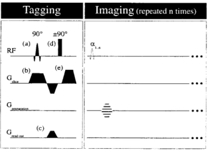 Fig.  1. CSPAMM myocardial tagging procedure in combination with  a  multi heart-phase segmented echo planar  imaging (EPI) sequence