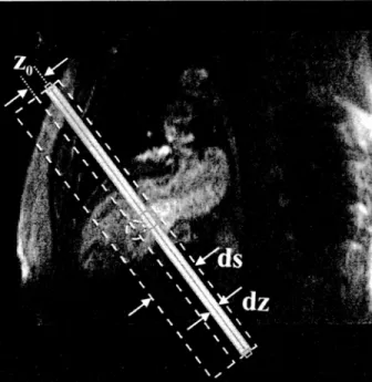 Fig.  3.  Planning  of a  double  oblique  short axis  tagging experiment  at  a  basal level of the  heart