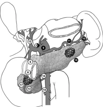 Fig. 1 Standard lymphadenectomy during pancreatectomy for pan- pan-creatic adenocarcinoma of the head and corpus or tail of the pancreas.