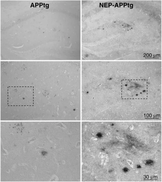 Fig. 1 Neprilysin deficiency exacerbates amyloid pathology in mouse brains. Frontal brain sections through the