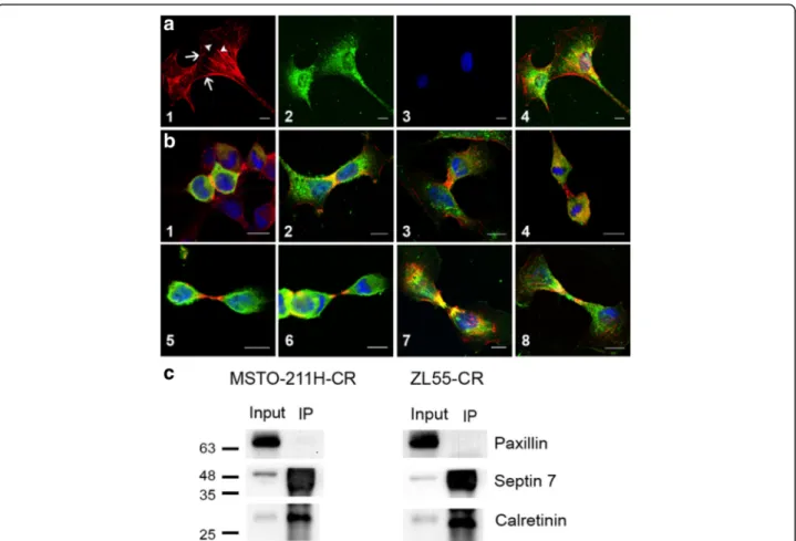 Fig. 6 Intracellular localization of calretinin and septin 7 in MM cells a Septin 7 localization (red; a1) and CR (green; a2) in MSTO-211H cells treated with 1 mM Bt