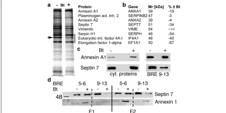 Fig. 3 Proteins differentially bound to the BRE9 – 13 DNA fragment a Silver-stained gel of proteins eluted from the BRE9 – 13 DNA-containing column from control MSTO-211H cells ( − ) or from Bt-treated (1 mM) cells (+) for 72 h; the region between 35 and 5