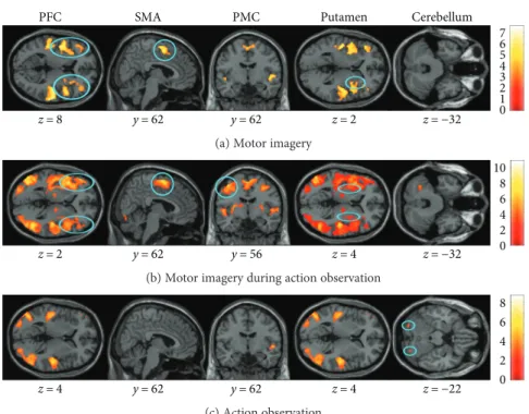 Figure 2: Common brain activity in young and elderly adults detected by a conjunction analysis