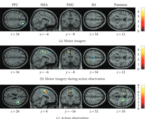Figure 3: Age-related di ﬀ erences in brain activity. The three mental simulation conditions were contrasted between age group by means of an ROI analysis