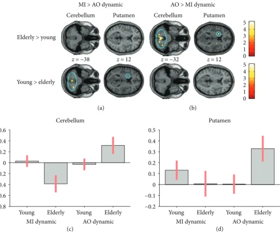 Figure 6: Age-related diﬀerences in the interactions between brain activity during motor imagery (MI) and action observation (AO), revealed by an ROI analysis