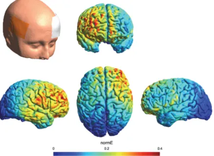 Fig 1. tDCS electric field distribution estimate. Results of the electric field distribution estimate are shown for the anode electrode over the rIFG (F6-FC6) and the cathode electrode over the left OFC