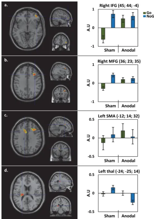 Fig 3. Functional neuroimaging results: Stimulation (Anodal; Sham) by Condition (Go; NoGo) Interaction.