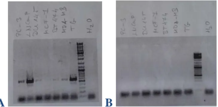 Fig S3. The complete RT-PCR blots. A) With reverse transcriptase enzyme. Lanes are the  following:  3 prostate and 3 breast cancer cell lines, followed by an extract from human  trigeminal  ganglia (TG) as a positive control, a bp ladder and a water (negat