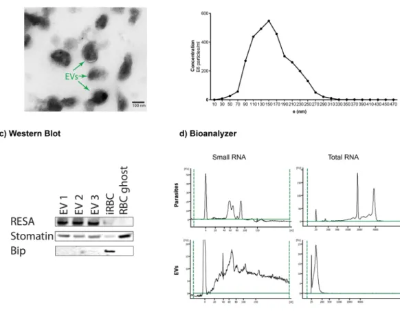 Figure 1.  Extracellular vesicles isolated from P. falciparum carry RNA. (a) Transmission electron microscopy  of EV preparation, purified EVs show individual EVs and a few clumps of varying sizes and intact lipid bilayers