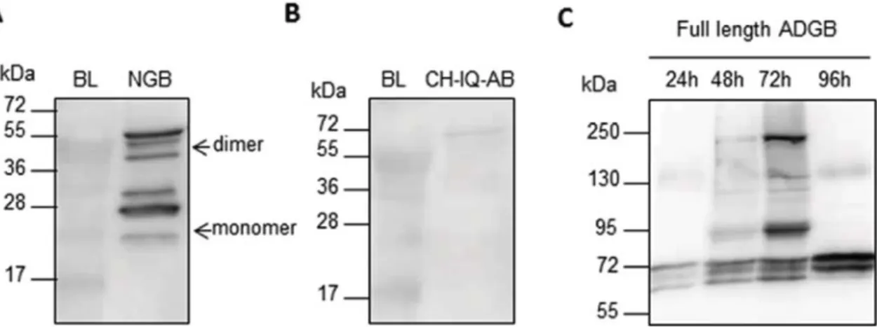Fig. 4. Western blot analysis (anti-His tag) (15% polyacrylamide) of E.coli, P.pastoris and Sf9 cell lysates were NGB was recombinantly in expressed