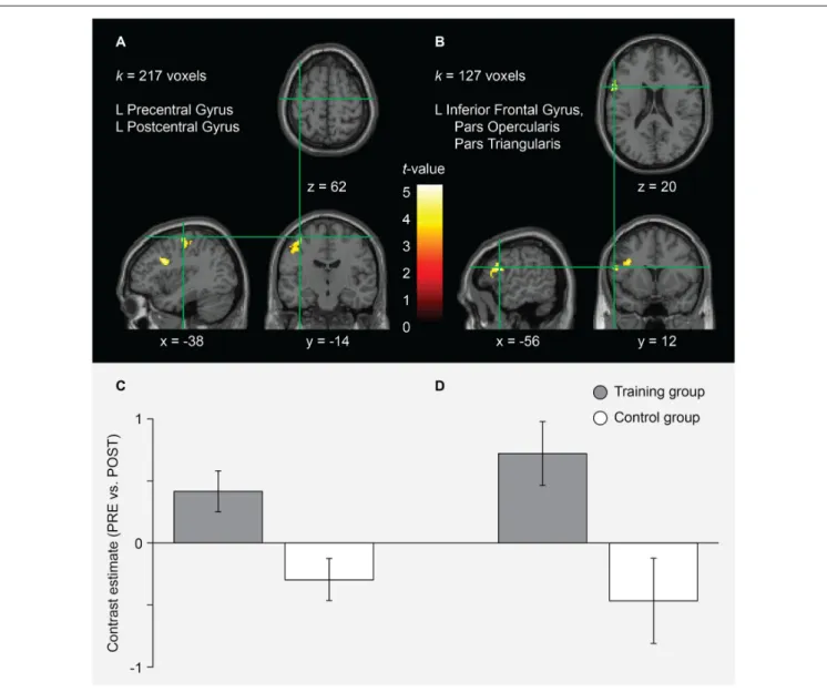 FIGURE 3 | fMRI results for the interaction of session and group in the AO+MI condition