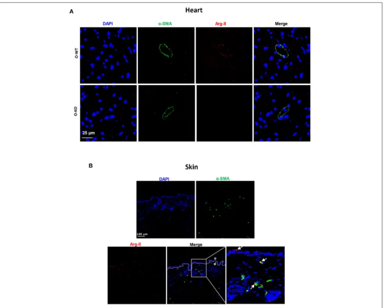FIGURE 4 | Immunostaining of Arg-II and α-smooth muscle actin (α-SMA) in an old WT mouse heart (A) and skin (B)